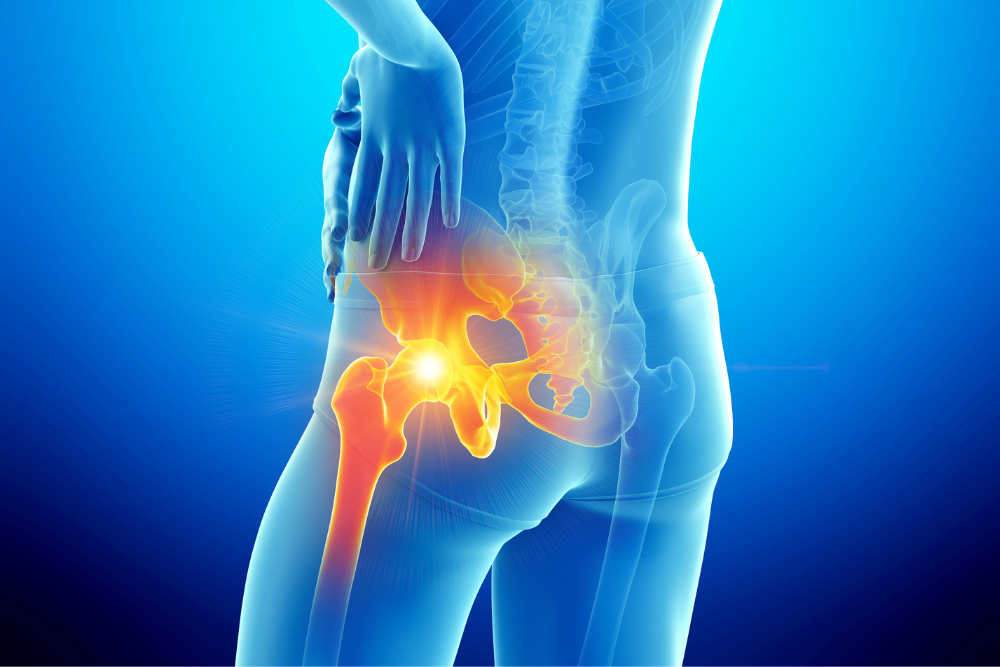 Knee Replacement Model